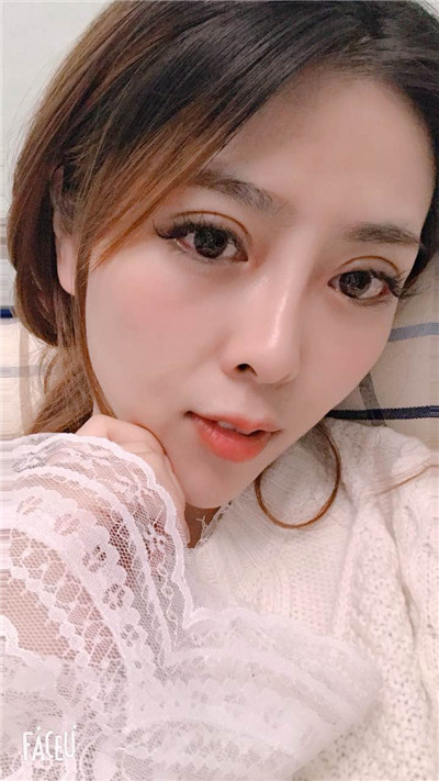 合肥亚典陈录翔眼部综合怎么样?价格案例分享