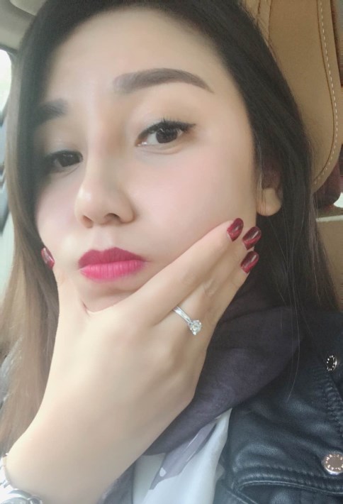 南京红颜会王凯军硅胶隆鼻怎么样?价格案例分享