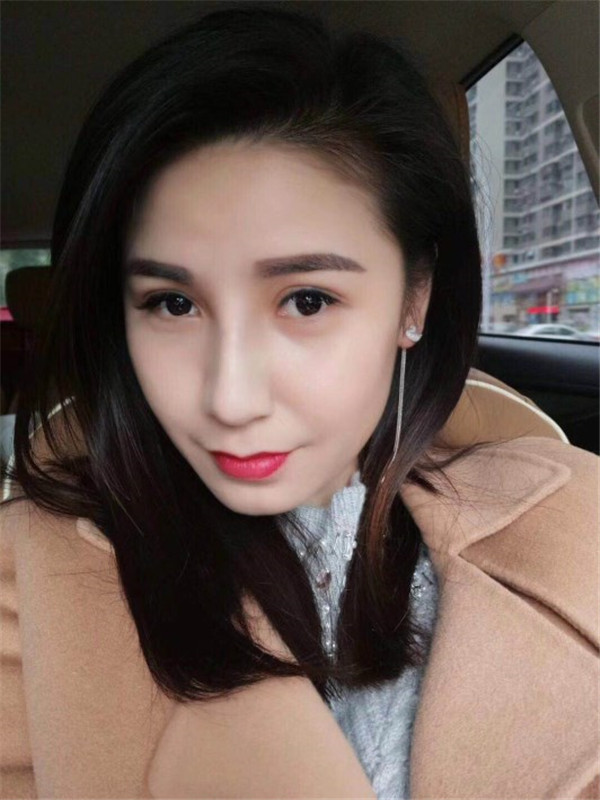 南京红颜会硅胶隆鼻怎么样?价格案例