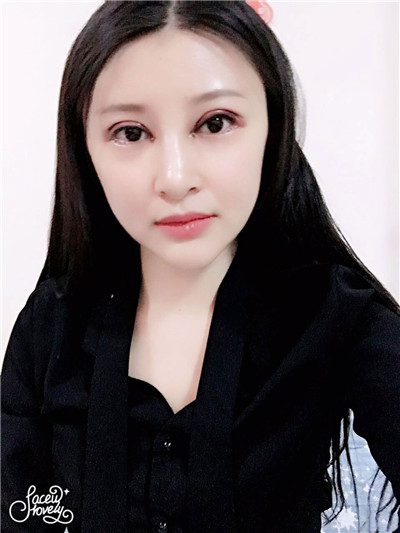 上海悦莱眼部综合唐勇怎么样?价格案例分享