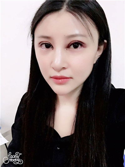 上海悦莱眼部综合唐勇怎么样?价格案例分享