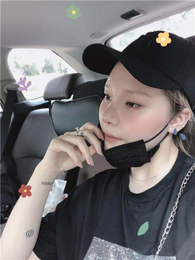 成都润美玉之光黄开亮肋软骨隆鼻怎么样?价格案例分享