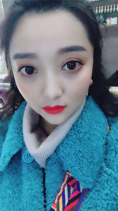 重庆艺星王方鹏切开双眼皮怎么样?价格案例分享