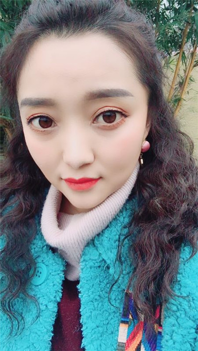 重庆艺星王方鹏切开双眼皮怎么样?价格案例分享