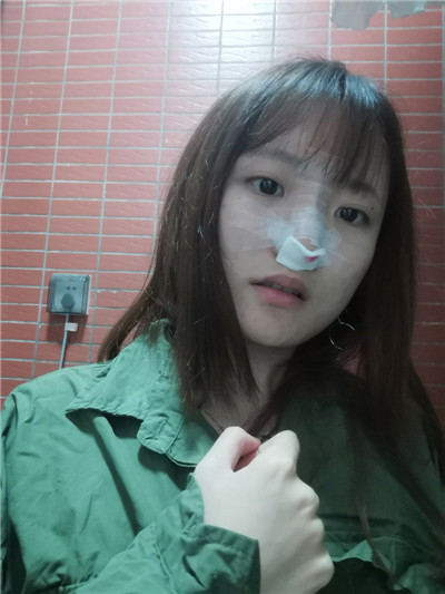 北京艺星薛轶群鼻部手术怎么样?价格案例分享
