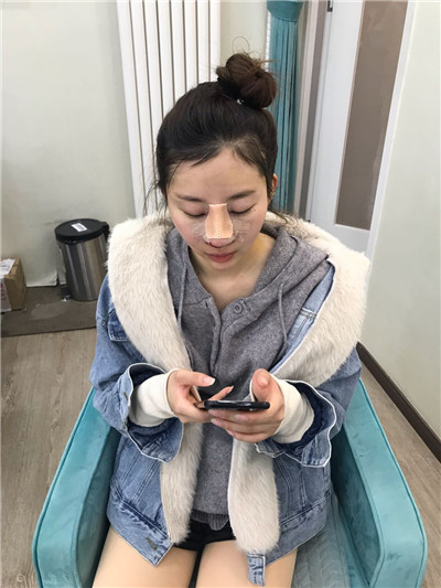 北京亚楠容悦蒋亚楠鼻部手术怎么样?价格案例分享