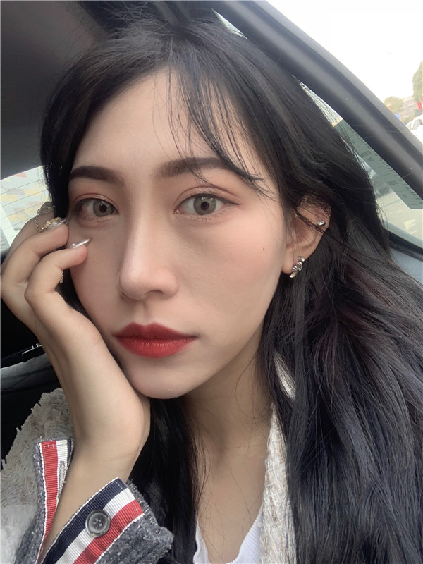 长沙半岛眼部手术怎么样?价格案例,第157天
