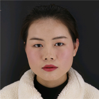贵阳华美杜良军鼻部手术怎么样?价格案例分享