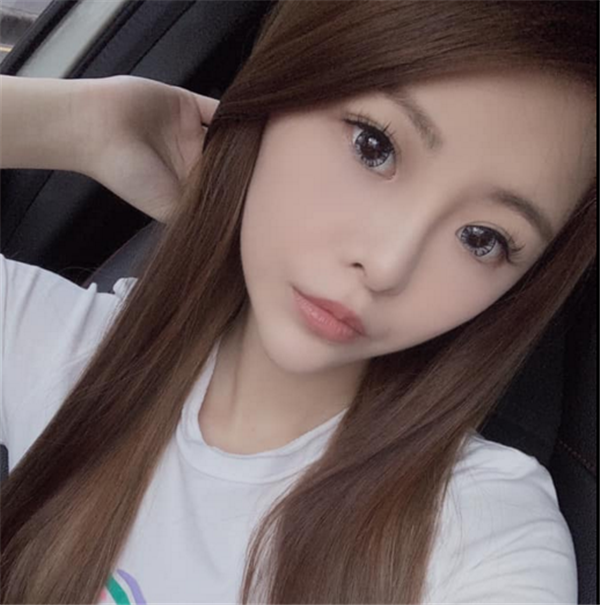 常州美贝尔鼻部手术37天怎么样?价格案例