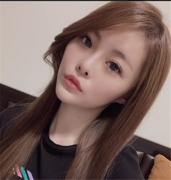 常州美贝尔鼻部手术37天怎么样?价格案例
