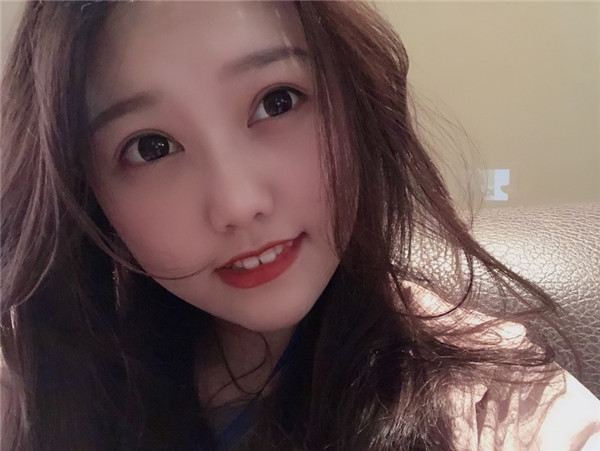 武汉奥黛丽双眼皮怎么样?价格案例37天