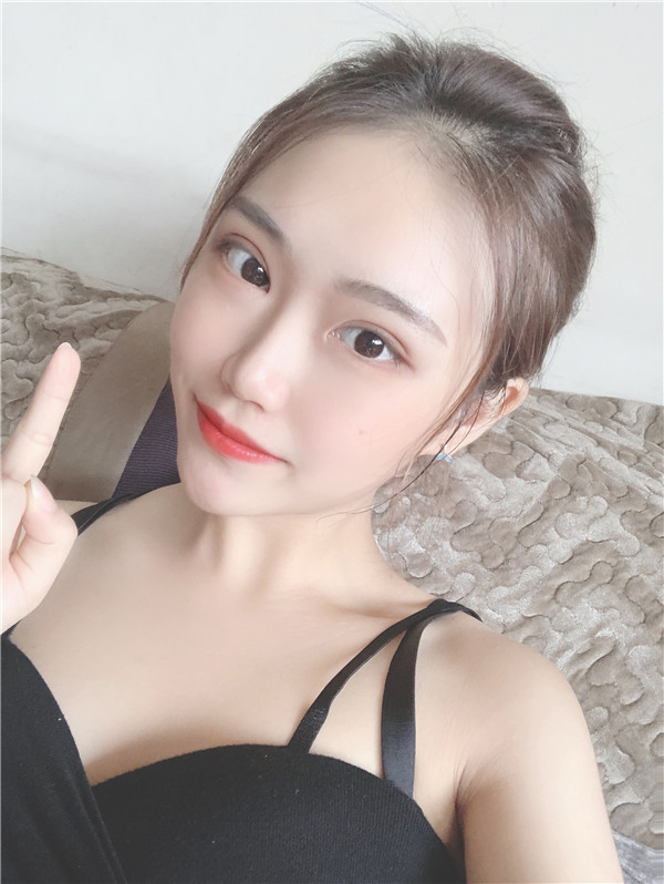 山西省整形医院吸脂怎么样?价格案例17天