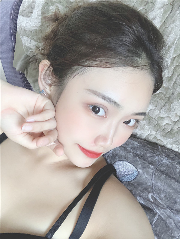 山西省整形医院吸脂怎么样?价格案例17天