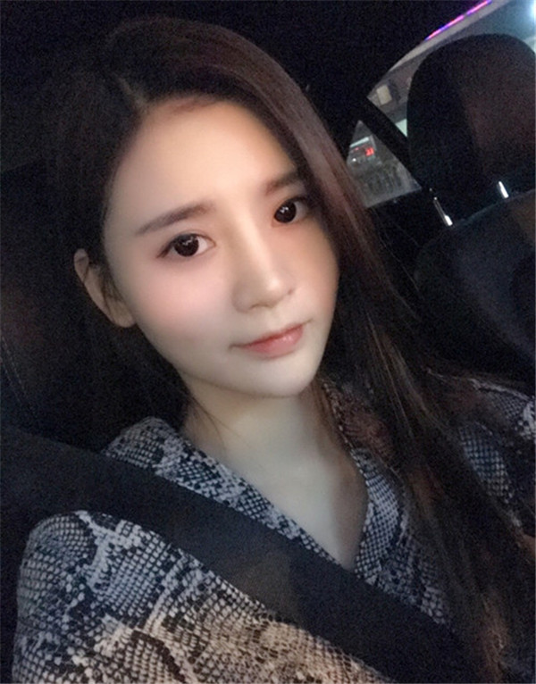 哈尔滨韩美脂肪丰卧蚕怎么样?价格案例59天