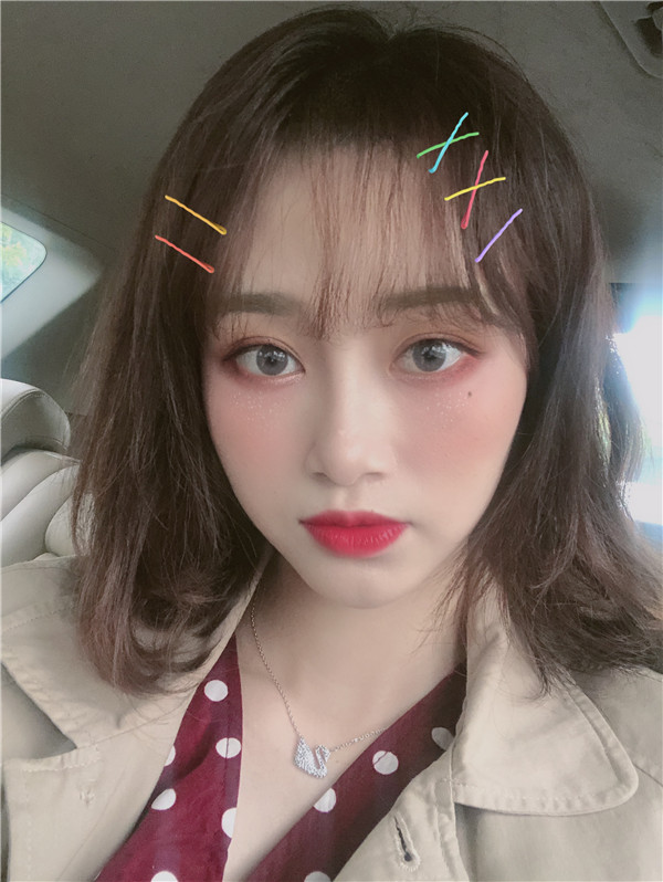 杭州艾尔莎奥拉克双眼皮怎么样?价格案例137天