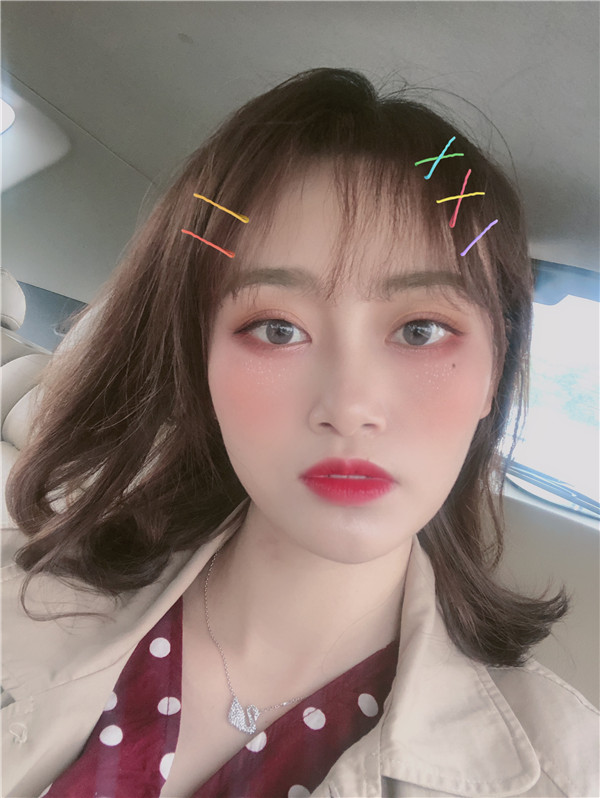 杭州艾尔莎奥拉克双眼皮怎么样?价格案例137天