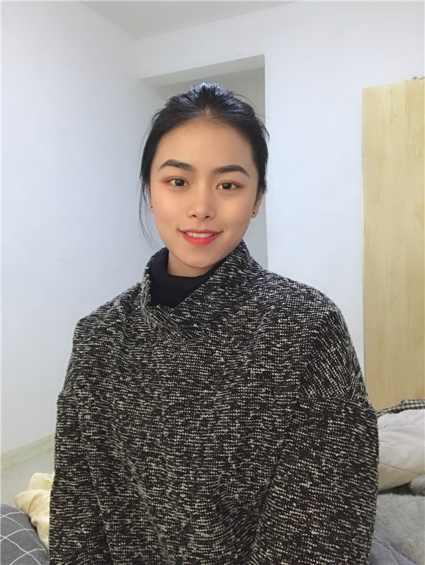 长春西之米双眼皮怎么样?价格案例96天