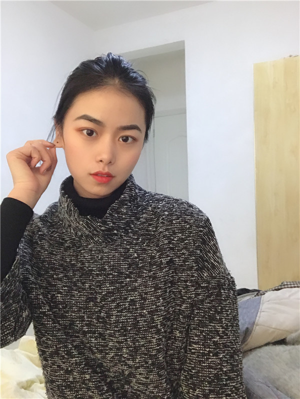 长春西之米双眼皮怎么样?价格案例96天