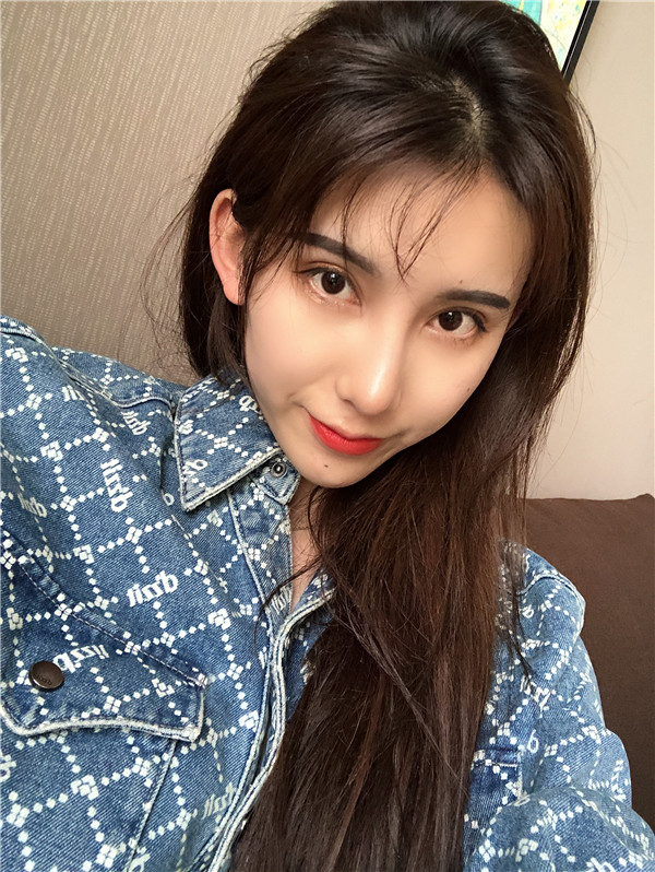 云南华美美莱隆鼻怎么样?价格案例31天