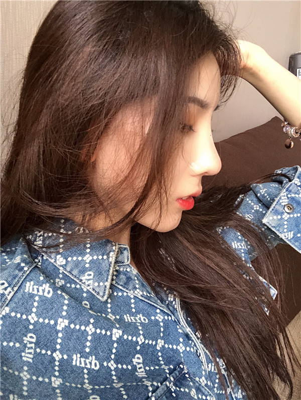 云南华美美莱隆鼻怎么样?价格案例31天