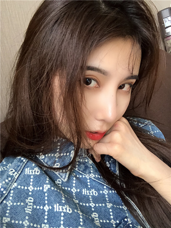 云南华美美莱隆鼻怎么样?价格案例31天