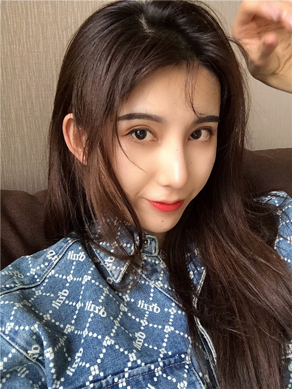 云南华美美莱隆鼻怎么样?价格案例31天