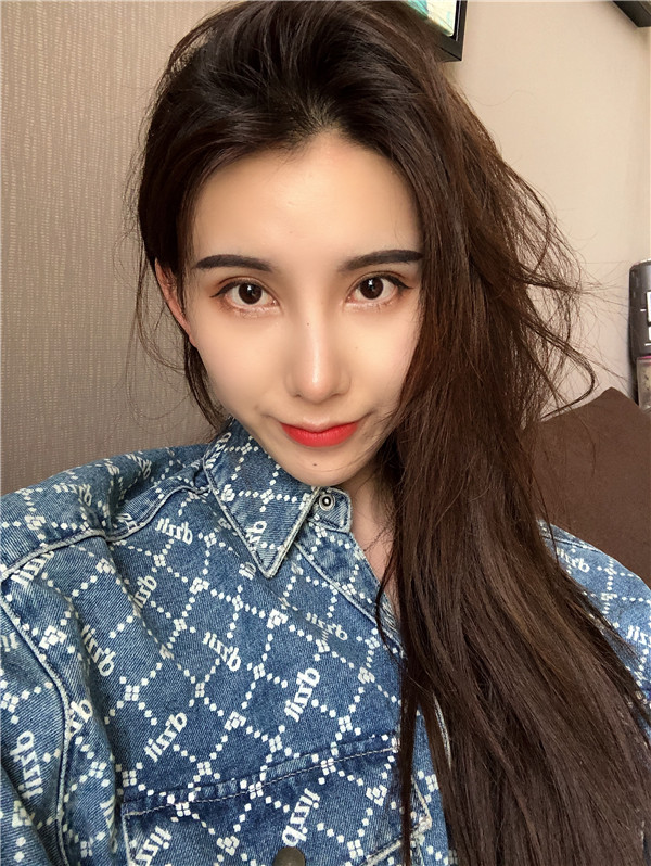 云南华美美莱隆鼻怎么样?价格案例31天