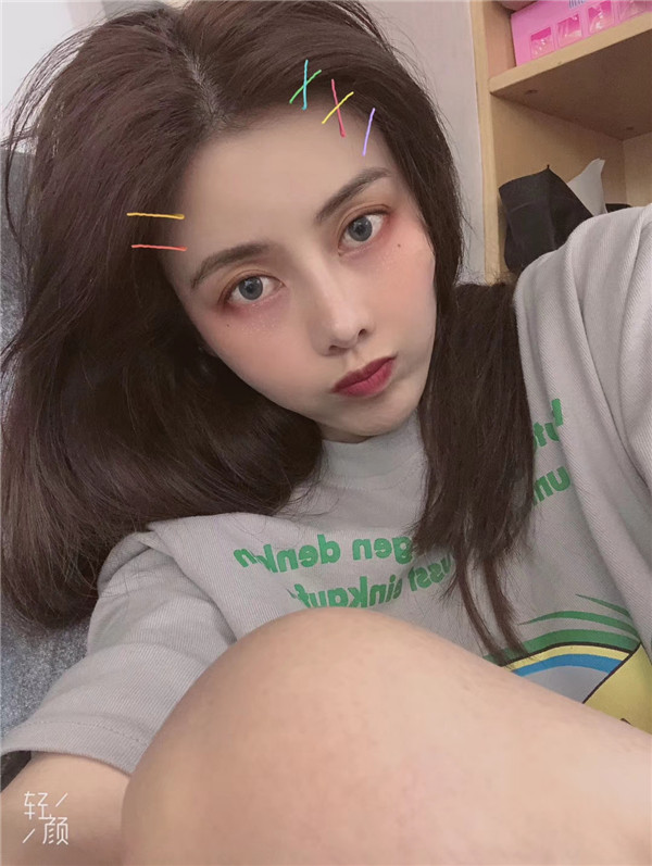 南昌优术隆鼻怎么样?价格案例36天