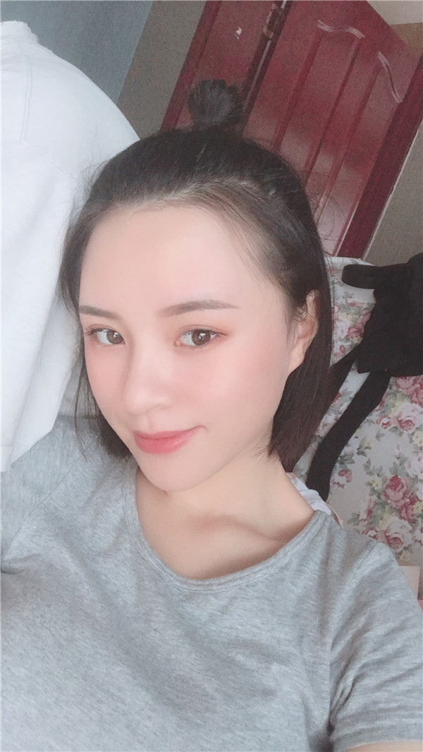 重庆华美隆鼻怎么样?价格案例165天