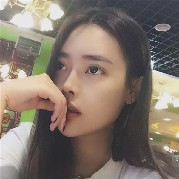 重庆鹏爱埋线提升怎么样?价格案例19天