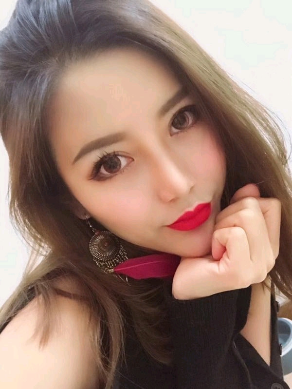 杭州时光下颌角磨骨怎么样?价格案例28天