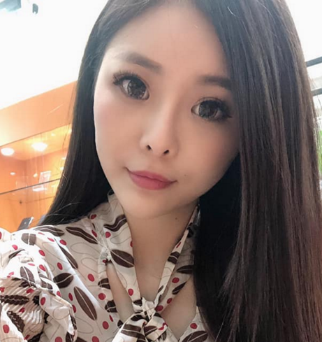 常州美贝尔鼻部手术怎么样?价格案例96天