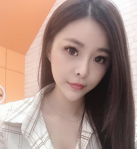 常州美贝尔鼻部手术怎么样?价格案例96天