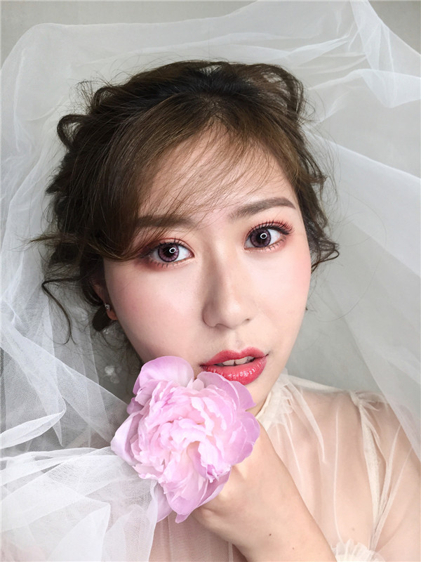 厦门安黛美隆鼻怎么样?价格案例233天