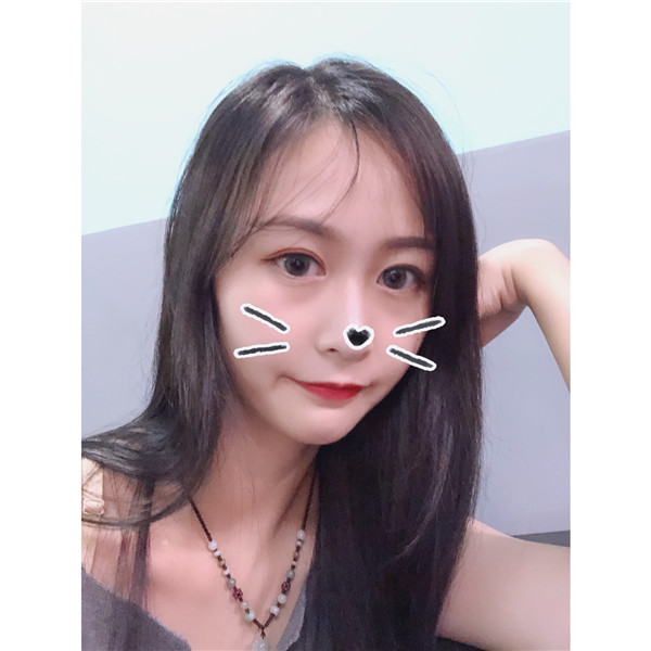 东莞维多利亚双眼皮怎么样?价格案例363天