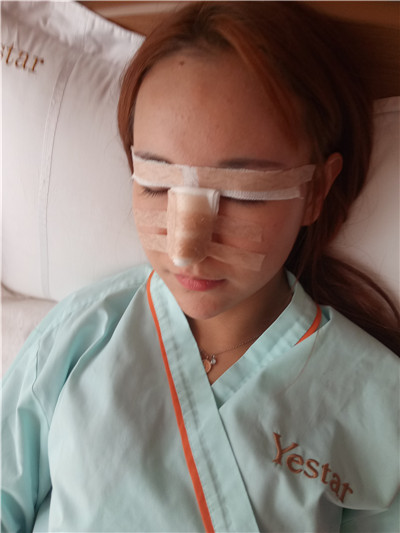 北京联合丽格师俊莉鼻部手术怎么样?案例分享