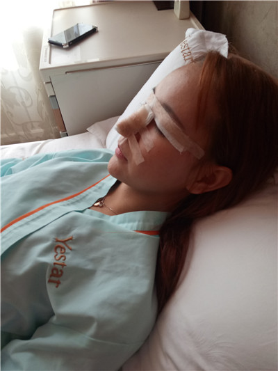 北京联合丽格师俊莉鼻部手术怎么样?案例分享