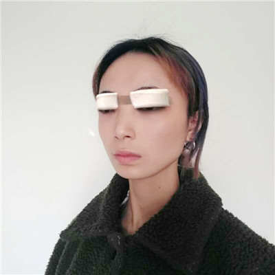 山西省整形外科刘晋元切开双眼皮怎么样?案例分享