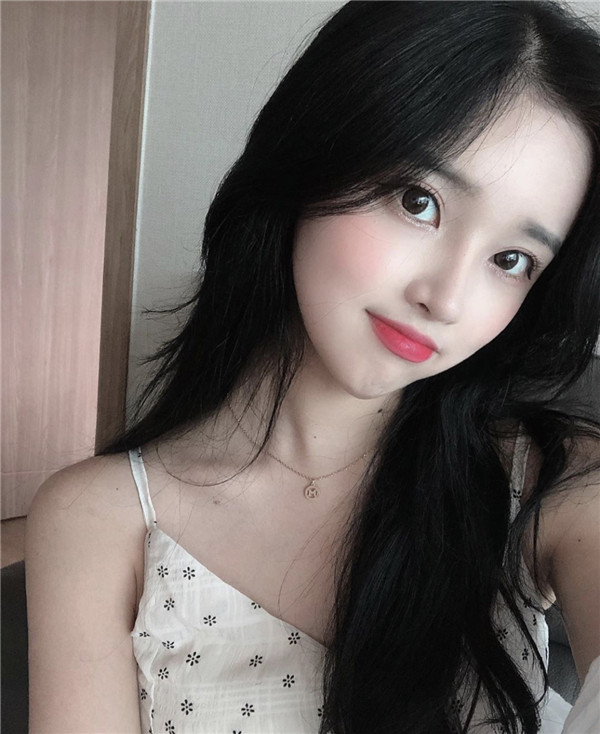 重庆美仑美奂眼部手术怎么样?价格案例21天