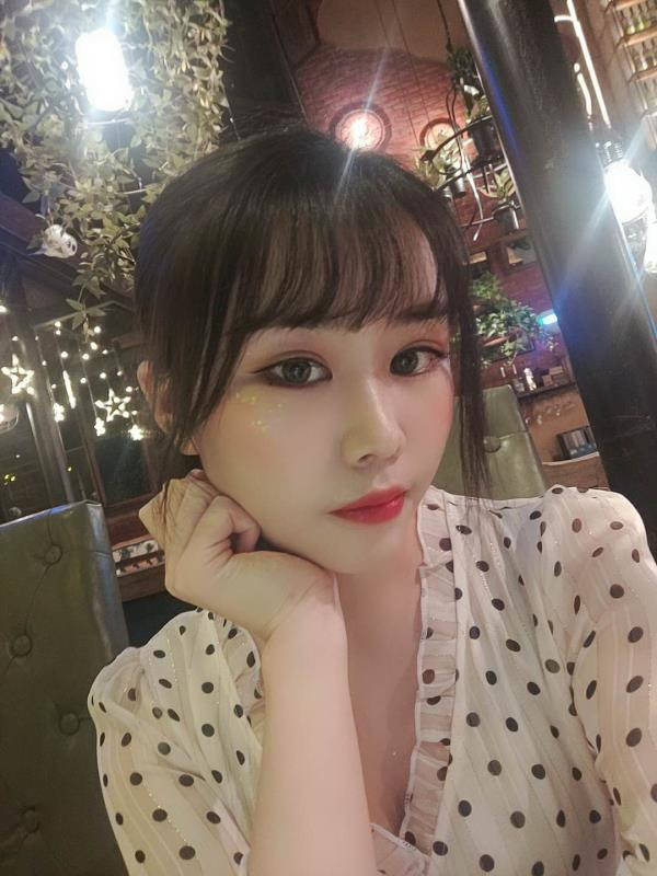 广州健丽鼻部手术怎么样?价格案例170天