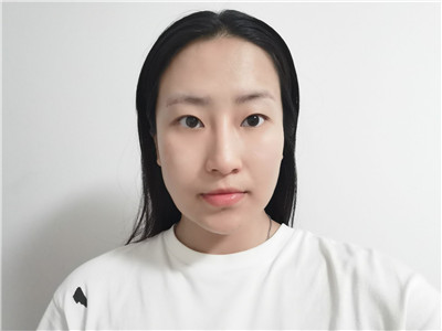 兰州亚韩医学李军梅鼻部手术怎么样?案例分享