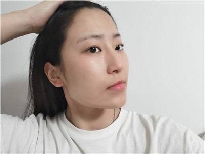 兰州亚韩医学李军梅鼻部手术怎么样?案例分享