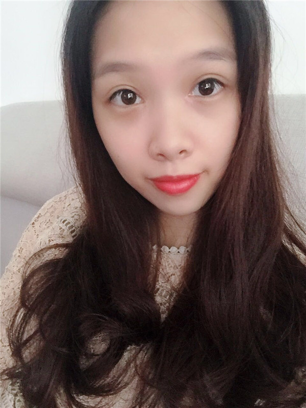 广州古汀眼部手术怎么样?价格案例79天