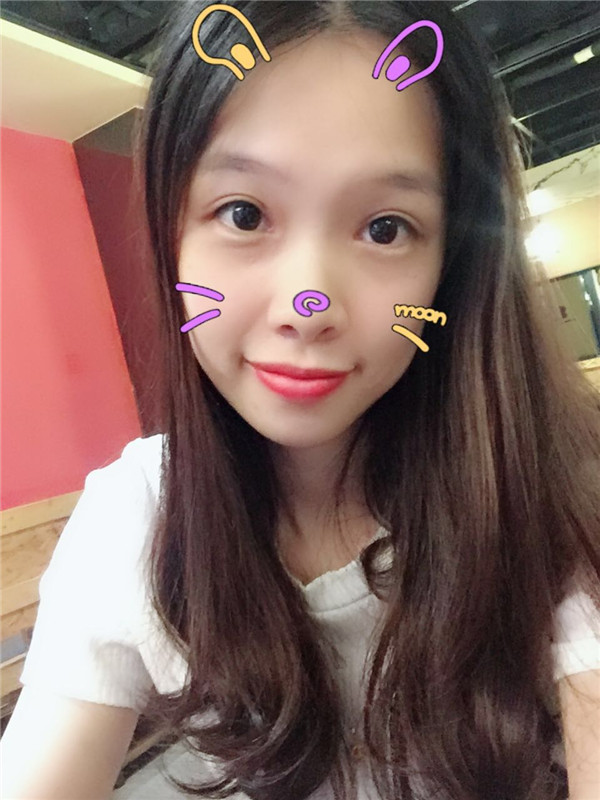 广州古汀眼部手术怎么样?价格案例79天