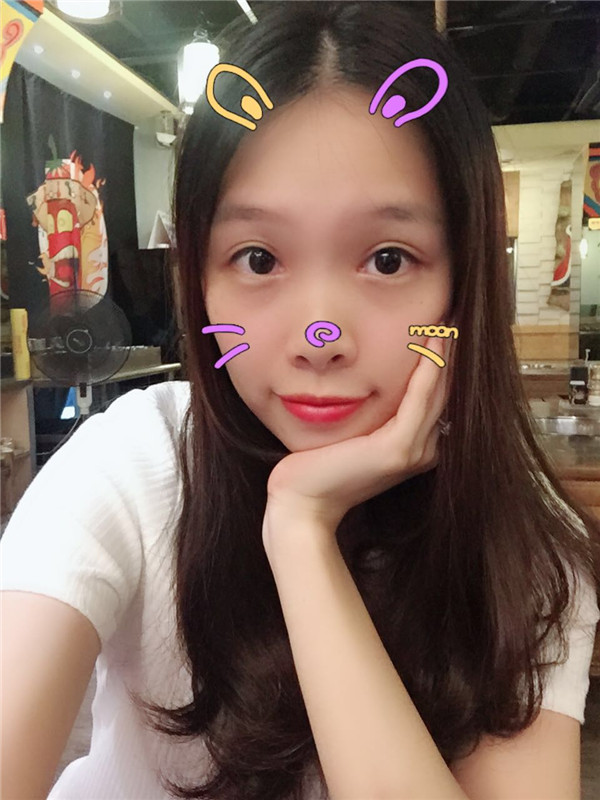 广州古汀眼部手术怎么样?价格案例79天