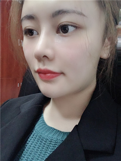 台州维多利亚艾长安鼻部手术怎么样?案例分享