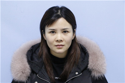 杭州时光胡斌鼻部手术怎么样?案例分享