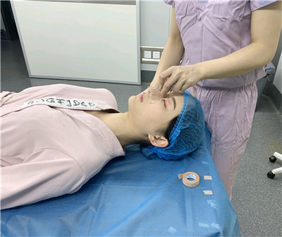 重庆铂生杜亚旭肋软骨隆鼻怎么样?案例分享