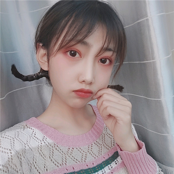 秦皇岛巧致双眼皮怎么样?价格案例45天