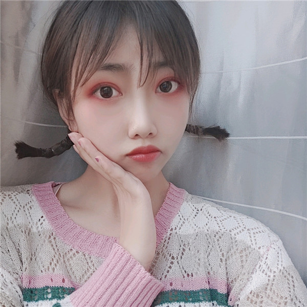 秦皇岛巧致双眼皮怎么样?价格案例45天